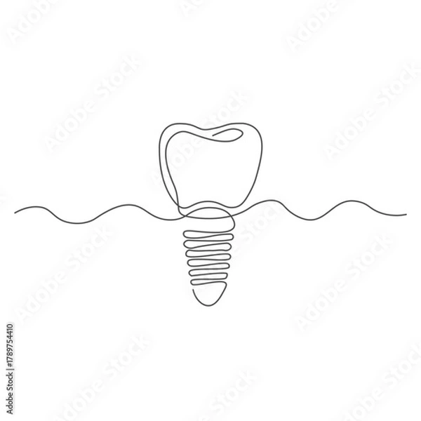 Fototapeta Continuous Line Drawing of a Dental Implant
