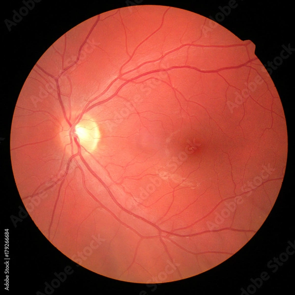 Obraz right eye's retinal image with macula, vessels and optic disc isolated view on a black bacground