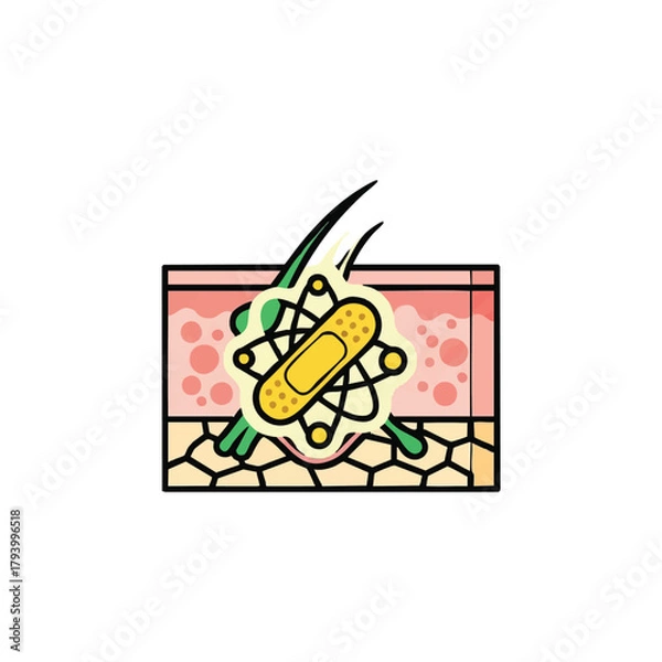 Obraz A stylized graphic depicts a cross-section of skin with hair follicles, inflammation, and a bandage, illustrating wound care or skin health treatment concepts.