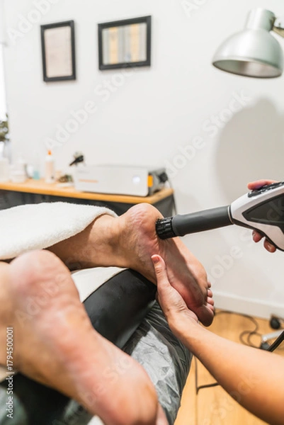 Obraz Therapist treating a patient's heel with shockwave therapy at a medical clinic for pain relief and recovery