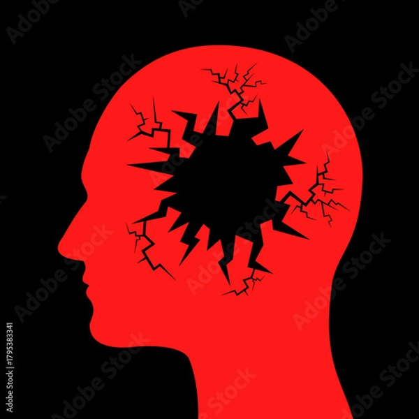Fototapeta Broken brain as poor mental health and mental disorder - degradation, worsening and deterioration of human head because of depression, dementia, alzheimer, nervous breakdown. Vector illustration.