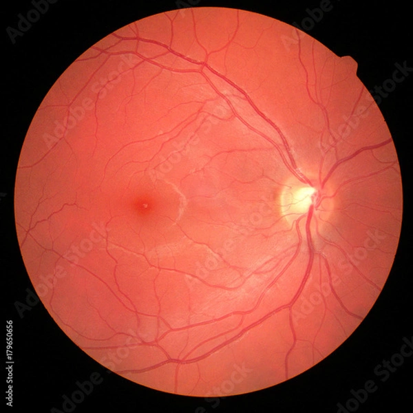 Obraz left eye's retinal image with macula, vessels and optic disc isolated view on a black bacground