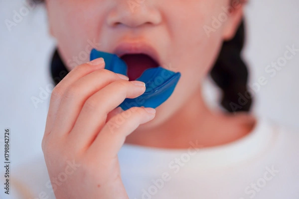 Obraz プレオルソを用いた子供の歯列矯正