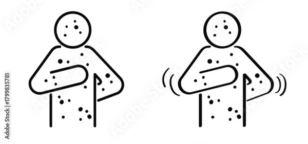 Obraz Skin rash, measles on face. Red rash on the body. A sign of measles, lupus, herpes, or rubella, and other autoimmune diseases. Rubeola or morbilli symptom. food allergy. Red spots on body. Itchy skin.