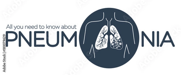 Obraz information banner  pneumonia