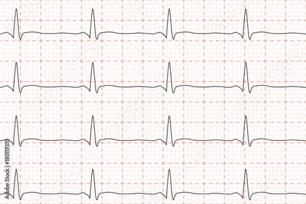 Fototapeta Cardiogram of heart beat. ECG on chart paper. Vector illustration.