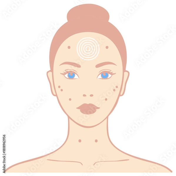 Obraz Woman's Face with Skin Problems or Ailments with Third Eye Chakra Illustration