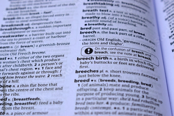 Fototapeta English Dictionary Page Close Up With The Word Meaning Of -breech birth