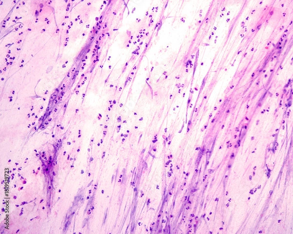 Obraz Sputum smear