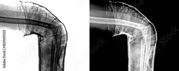 Obraz Elbow Lateral View X-Ray Radiograph Showing Detailed Bone Alignment and Joint Structure for Accurate Diagnosis of Elbow Fractures and Traumatic Injuries Isolated on Transparen
