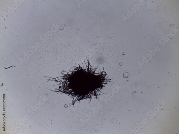 Fototapeta Microscopic View of Chaetomium Fungi Perithecium, Showing Diagnostic Dark and Intricate Hairs for Taxonomic Identificatio