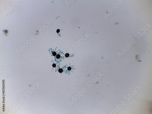 Fototapeta Detailed Microscopy of Powdery Mildew Fungi Sexual Stage: Spherical Ascocarp with Terminal Appendages for Species Identificat