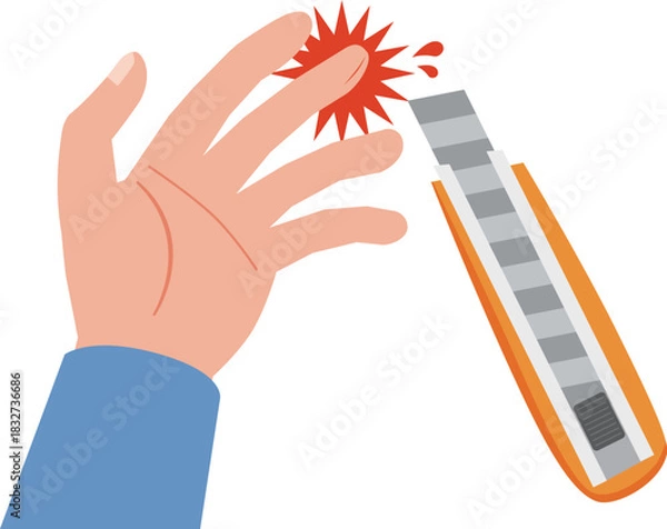 Obraz カッター使用中のケガ