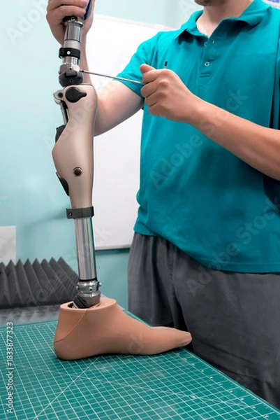Obraz Adjustment and adjustment of the leg prosthesis at the knee joint by a prosthetic technician