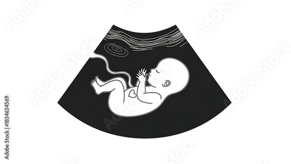 Obraz Stylized black and white ultrasound image showing a fetus with an umbilical cord inside the womb, representing prenatal development.
