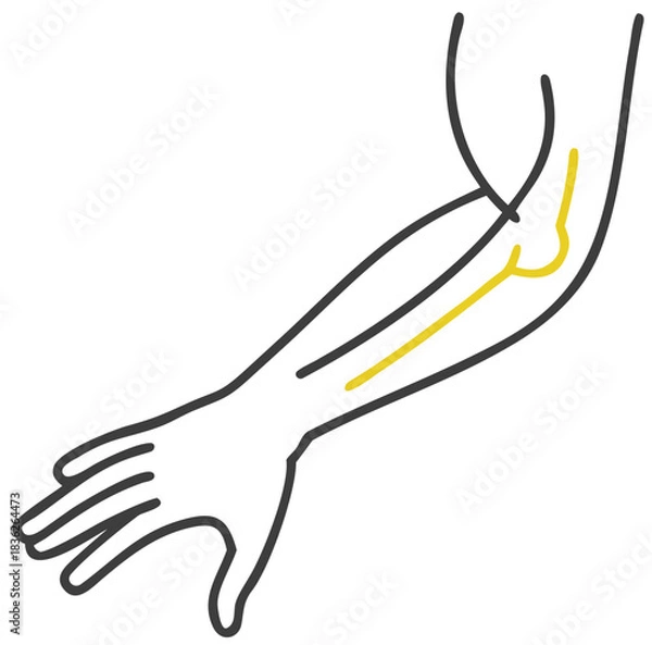 Obraz Ulnar