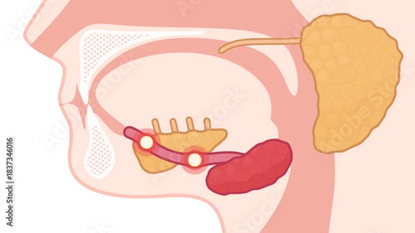 Fototapeta 唾石症のイラスト