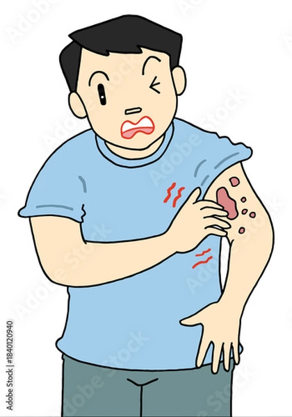 Obraz 病気・疾患のイラスト - 蕁麻疹・ヘルペス・皮膚疾患