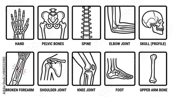 Fototapeta Human Skeletal System Diagram – Labeled Illustrations of Skull, Spine, Joints, Limbs, and Fracture for Medical, Educational, and Orthopedic Reference