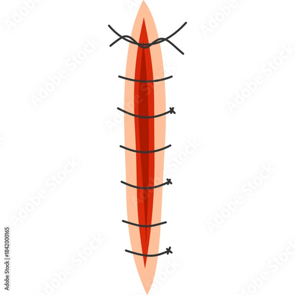 Obraz Suture Illustration