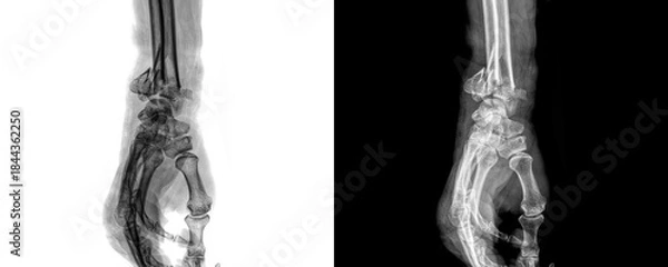 Obraz Wrist Joint Lateral View X-Ray Radiograph Depicting Bone Integrity, Joint Spacing, and Soft Tissue Shadows for Clinical Diagnosis and Evaluation, Isolated on Transparent