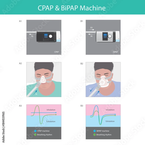 Obraz Comparison of CPAP and BiPAP Machine Function