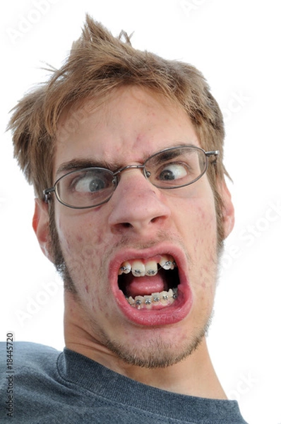 Obraz Man smiling showing his braces