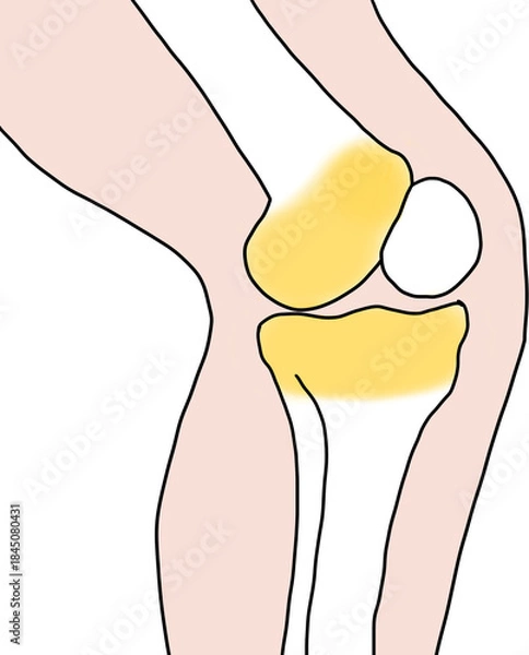Obraz 무릎 뼈 성장판