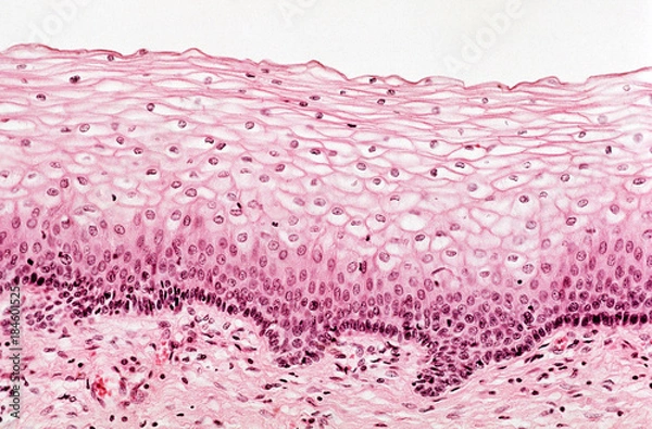 Obraz Ectocervical epithelium