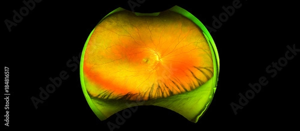 Obraz eye's retinal angle image with macula, vessels and optic disc isolated view on a black bacground. made by ultra wide fundus camera