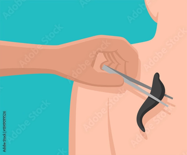 Fototapeta Laser welding machine with handheld industrial torch