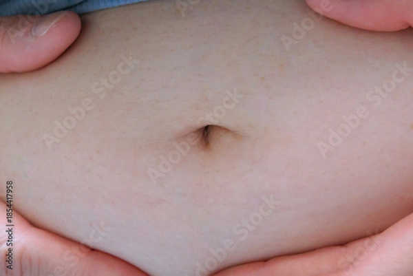 Obraz 太った女性のおなかを手で抑える　腹　肉　脂肪　体型