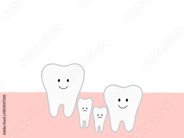 Fototapeta 乳歯の生え変わりによる埋没歯・過剰歯と歯並びの乱れのイラスト