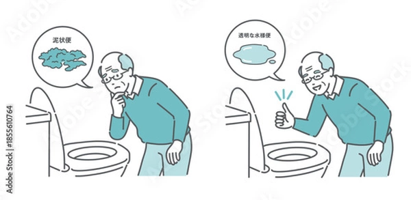 Obraz 大腸カメラ前処置の便の状態比較イラスト（高齢男性・泥状便NG・透明な水様便OK）