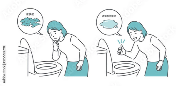 Obraz 大腸カメラ前処置の便の状態比較イラスト（女性・泥状便NG・透明な水様便OK）