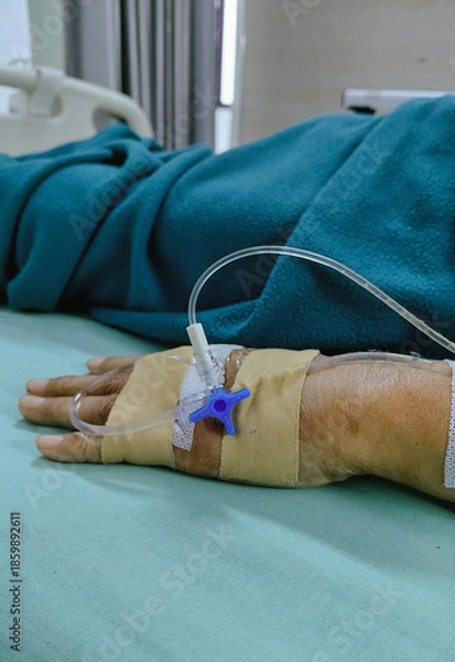 Obraz Close up of a patient hand with an IV drip for medical treatment in a hospital setting.