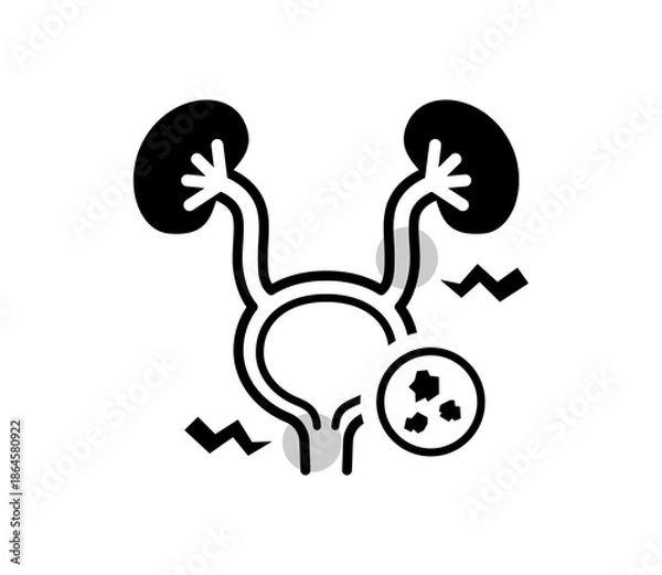 Obraz 尿路結石のアイコンイラスト　ベクター