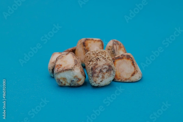 Fototapeta 手術で摘出された多数の胆石、青背景