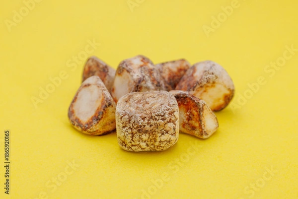 Fototapeta 手術で摘出された多数の胆石、黄背景