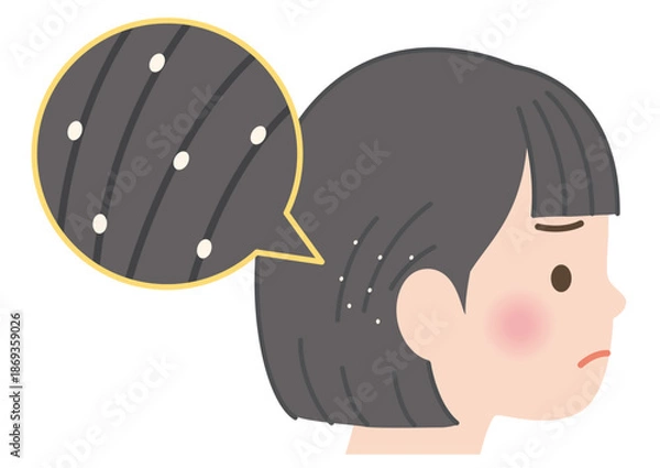 Obraz 髪にアタマジラミの卵が付着している子供