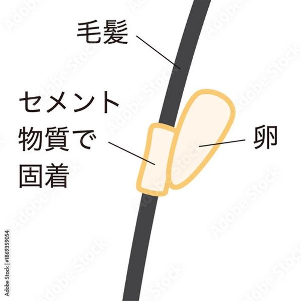 Obraz アタマジラミの卵