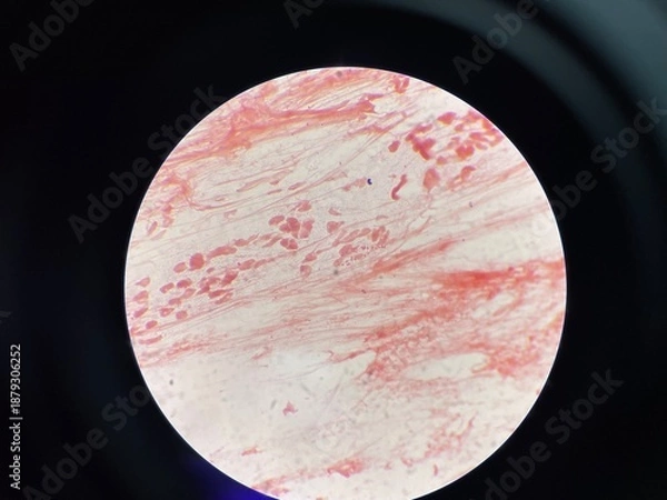 Obraz Gram negative diplococci sample pus from penis.
