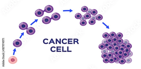 Fototapeta cancer cell stage and development vector