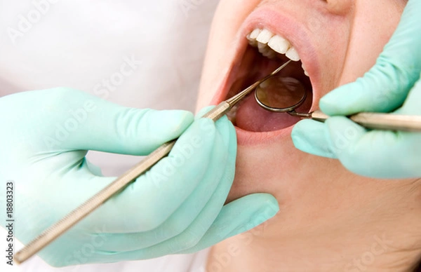Obraz dental examination