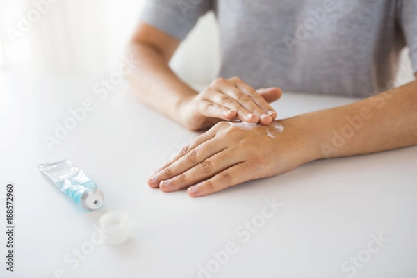 Fototapeta close up of hands with cream or therapeutic salve
