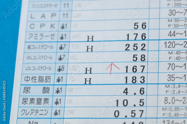 Obraz コレステロールと中性脂肪の高い値を示している血液検査の結果