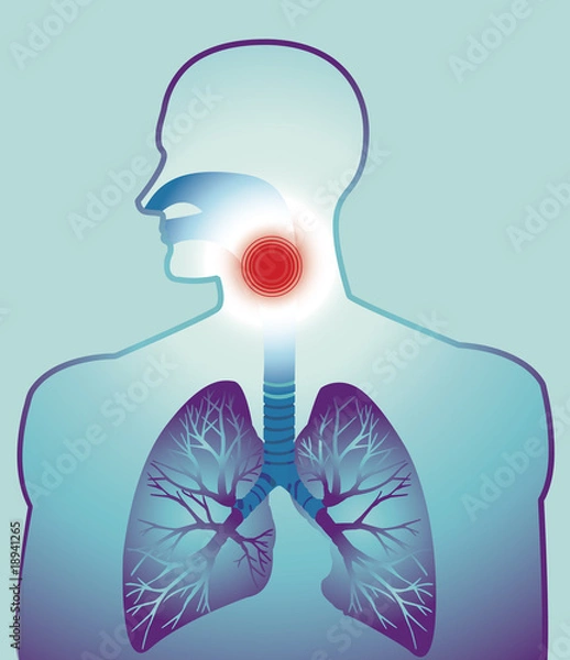 Fototapeta Sore throat