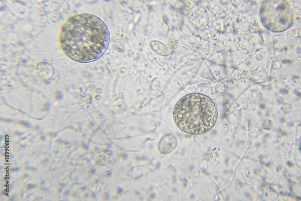 Fototapeta Chlamydomonas algae, paramecium ciliates and many bacteria through microscope