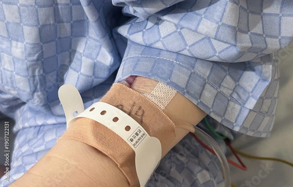 Obraz 腫れている点滴中の腕