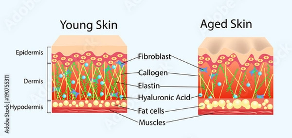 Fototapeta Vector diagram with schemes of two types of skin, for healthcare illustrations